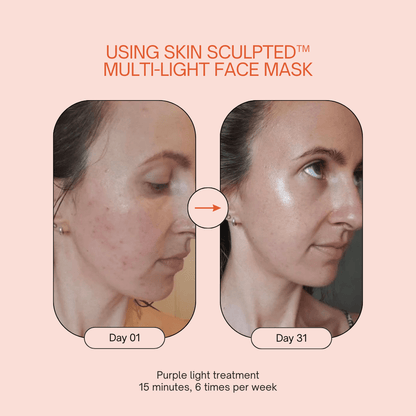 Skin Sculpted™ Multi-Light Face Mask