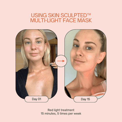 Skin Sculpted™ Multi-Light Face Mask